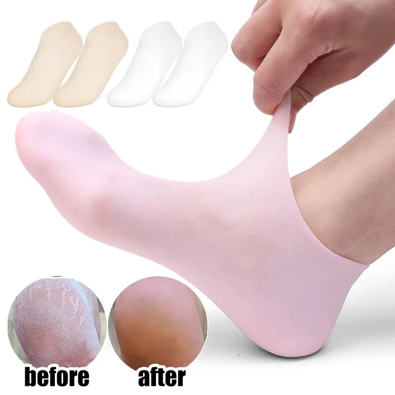 1 Pair Silicone Moisturizing Gel Heel Socks