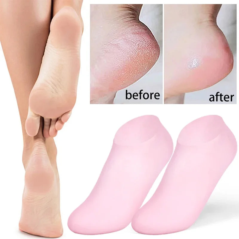 1 Pair Silicone Moisturizing Gel Heel Socks